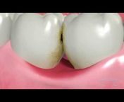 Dentalism