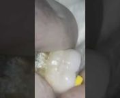 Dentistry Online طب الأسنان مباشر