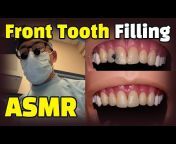 Dental Procedures Explained