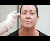 Dr Darren McKeown - Cosmetic Surgery, Botox u0026 Lip Fillers