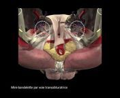 Urologie fonctionnelle - Anatomie