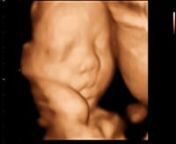 Baby Boy 29 weeks, 4D Ultrasound Video Clip recorded in Tri-Cities 3D Sono Image Coquitlam BC, Dec 2009