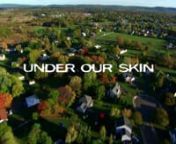 A dramatic tale of microbes, medicine &amp; money, this Oscar semifinalist investigates the untold story of Lyme disease.nunderourskin.com