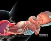 Esta animación médica 3D representa un parto vaginal normal, destacando especialmente las tres etapas del parto. Durante un parto vaginal, la primera etapa del trabajo de parto dura alrededor de 12 a 19 horas, y comienza cuando el bebé se asienta más baja en su pelvis. Al comienzo de la segunda etapa del trabajo de parto, que suele durar de 20 minutos a 2 horas, el cuello del útero está completamente dilatado a 10 centímetros, y la cabeza del bebé se ha movido más allá de la abertura c