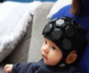 LUMO is a wearable, scalable and high-density fNIRS brain imaging technology that combines unprecedented functional imaging capability with outstanding experimental flexibility.