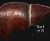 Reworked the 3D liver. Ran a test compared to no subsurface scattering vs a model with subsurface scattering texture layer and its lighting difference. Created this for a MA animation project, more record of making or tests to come on this Deathlake channel!nMain art YouTube: Deathlake nSide art and animation channel “Madam Deathlake”u000bnYouTube vlogs: suki42deathlake channel u000bnYouTube Product reviews: Deathlake speaks u000bnYouTube Games at DeathlakeHatesGamesu000bnFacebook at Suki4