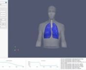 The Pulse Physiology Engine is a powerful tool in computing the physiological responses to acute injury and treatment, such as anaphylaxis. This video shows a visualization tool built on the ParaView platform to use and display the results of the physiology engine. The Pulse Physiology Engine Explorer allows the user to execute the anaphylaxis demo by beginning the simulation with a healthy patient. Anaphylaxis is then simulated by applying an airway obstruction that represents the blocked airwa