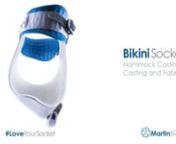 The Bikini Socket has become a standard of care for hip disarticulation and hemipelvectomy prosthetics users, with hundreds of successful fittings. It offers significantly greater control, comfort, and functional outcomes. nnOur Hammock Casting Stand provides an even better capture of the underlying anatomy in the casting process. Using our compliant force distribution techniques, we now cast the user while suspending them in a fabric hammock – which provides a socket that is perfectly contour