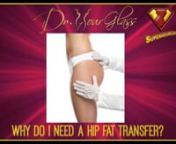 When performing tummy tucks or other similar procedures, the hip area needs to be given careful attention. 90% of women do not have hips, and the ones who do have some sort of indentation, or the blend between the hip and thigh is not proportionate. Oftentimes, many patients wonder why they still need fat transfer even if they already have hips. For starters, a wide hipbone does not necessarily equate to curves. You can be wide and not have shape. Fat transfer does not only make your hips bigger