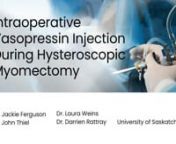 Intraoperative Vasopressin Injection During Hysteroscopic Myomectomy from vasopressin injection