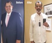 Baptist Health’s Weight-loss Surgery Program helped Alfredo lose more than 100 pounds. Take a look at his remarkable journey.n nRegister for one of our free seminars with one of our surgeons at BaptistHealth.net/Weightloss to learn more about weight-loss surgery.nnTRANSCRIPTn
