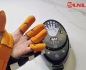 Sunlion #finger exercise hand #rehabilitation #robot #gloves FR01 brings fully exercise for each fingers: under program D, the bionic robotic pneumatic glove drives each finger to bend and straighten for 3 times, as video shows, such fully exercise one finger by one finger, improving grip strength, increasing dexterity and bettering range of motion for#stroke #patients with hand #paralysisnPlease subscribe us for more if possible.n#handstroke #handparalysis #rehabilitationgloves