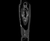 In July 2011, Field Museum scientists used a portable CT scanner to investigate a few of the mummies in our collections. These reconstructed images are just a sample of the data collected and analyzed over the last year.