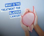 Dr Rob explains all you need to know about bladder cancer including signs, symptoms and treatment.