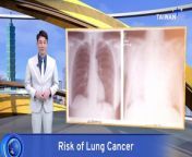 Doctors at Taipei Veterans General Hospital have found evidence that the risk of lung cancer is more closely linked to genetics than smoking habits.