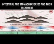 Intestinal and stomach diseases and their treatment #intestine#stomach