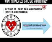 What is daily ECG (Holter) monitoring? #holter #ecg