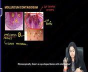 Skin pathology from maharani de skin gp