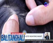Kakambal ng tag-init, ang makati sa anit na mga kuto!&#60;br/&#62;&#60;br/&#62;&#60;br/&#62;Balitanghali is the daily noontime newscast of GTV anchored by Raffy Tima and Connie Sison. It airs Mondays to Fridays at 10:30 AM (PHL Time). For more videos from Balitanghali, visit http://www.gmanews.tv/balitanghali.&#60;br/&#62;&#60;br/&#62;#GMAIntegratedNews #KapusoStream&#60;br/&#62;&#60;br/&#62;Breaking news and stories from the Philippines and abroad:&#60;br/&#62;GMA Integrated News Portal: http://www.gmanews.tv&#60;br/&#62;Facebook: http://www.facebook.com/gmanews&#60;br/&#62;TikTok: https://www.tiktok.com/@gmanews&#60;br/&#62;Twitter: http://www.twitter.com/gmanews&#60;br/&#62;Instagram: http://www.instagram.com/gmanews&#60;br/&#62;&#60;br/&#62;GMA Network Kapuso programs on GMA Pinoy TV: https://gmapinoytv.com/subscribe